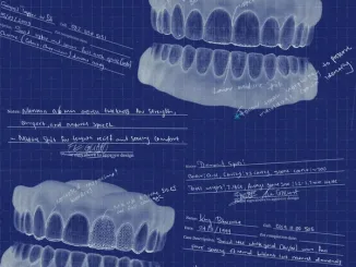 K1llbrady - Skyami ft. Blxckie Mposa.Co.Za